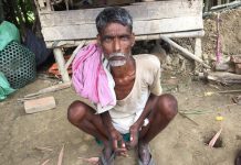 रौतहटका कुष्टरोगीको यर्थात, उपचारका लागि काठमाडौं