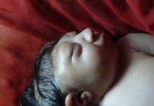 कपिलवस्तु : आठ दिन नपुग्दै दुई टाउके नवशिशुको मृत्यु
