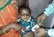 महोत्तरीका ७ हजार बालबालिका कुपोषणको शिकार