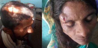 पानी निकासको विषयमा दुई पक्षबिच भएको झगडामा परि ७ जना घाईते