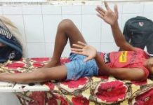 चोरीको आरोपमा १५ वर्षीय किशोरमाथि प्रहरीद्वारा निर्घात कुटपिट